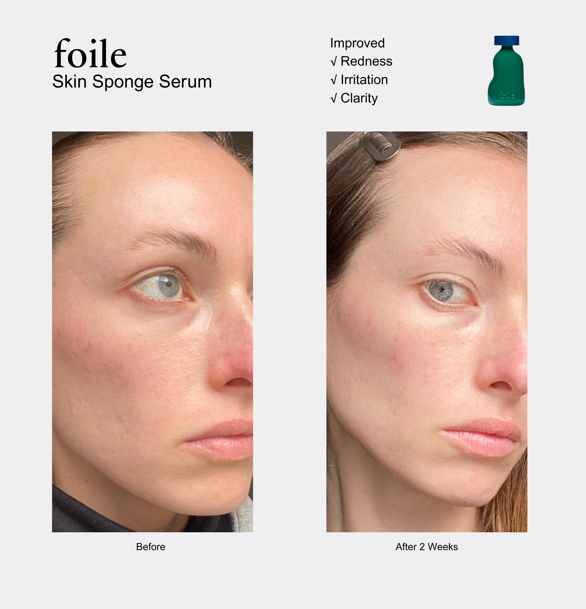 Foile - Skin Sponge Serum: REFILL 50ML